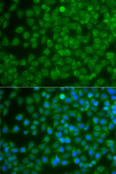 Immunofluorescence - SPIB Polyclonal Antibody 