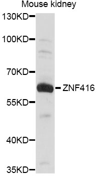 Western blot - ZNF416 Polyclonal Antibody 