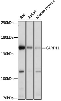 Western blot - CARD11 Polyclonal Antibody 