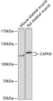 Western blot - CAPN3 Polyclonal Antibody 