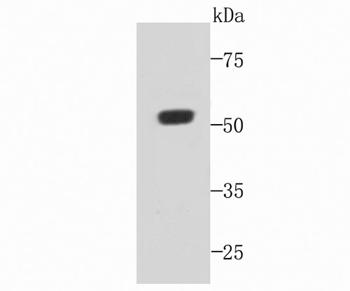 Fig1: Western blot analysis of C19orf35 on recombinant protein using anti-C19orf35 antibody at 1/1,000 dilution.