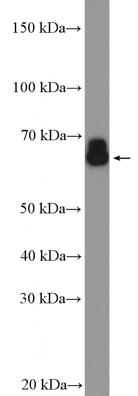 mouse testis tissue were subjected to SDS PAGE followed by western blot with Catalog No:113621(PDILT Antibody) at dilution of 1:1000