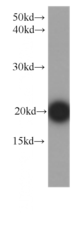 human brain tissue were subjected to SDS PAGE followed by western blot with Catalog No:107207(FGF12 antibody) at dilution of 1:1000