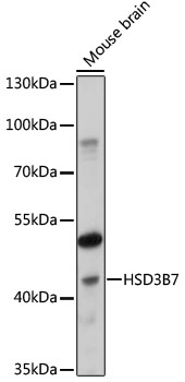 Western blot - HSD3B7 Polyclonal Antibody 