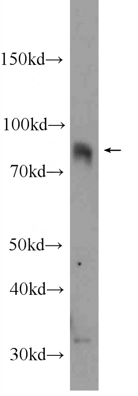 Jurkat cells were subjected to SDS PAGE followed by western blot with Catalog No:109316(CIN85 Antibody) at dilution of 1:1000