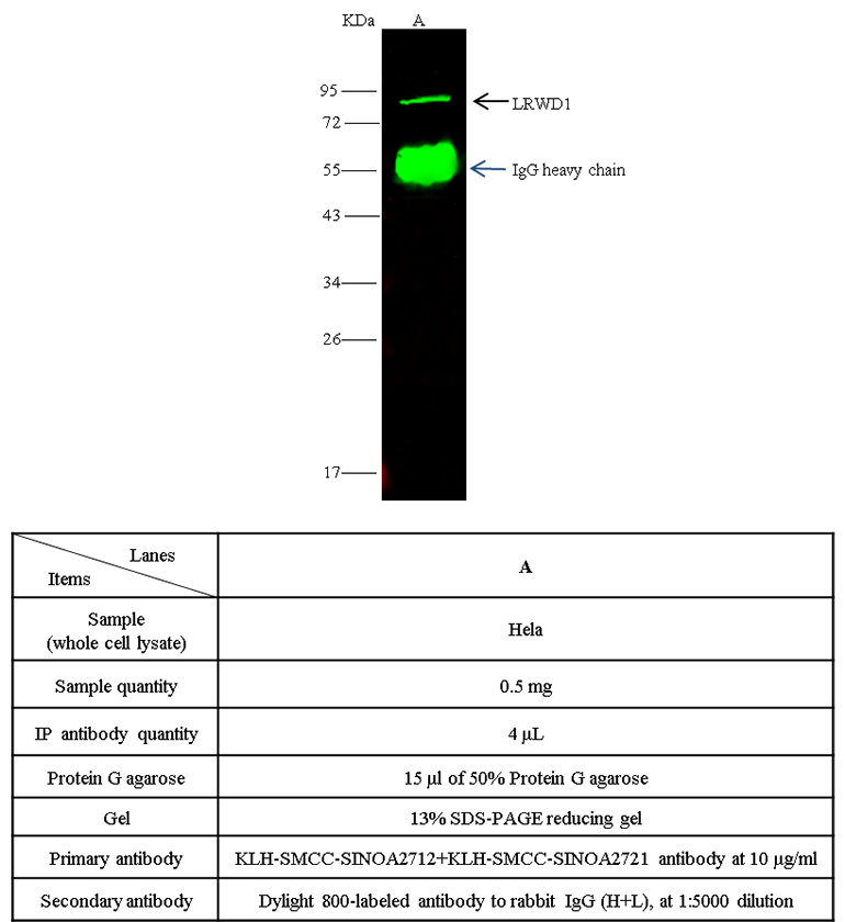LRWD1 Antibody, Rabbit PAb, Antigen Affinity Purified, Immunoprecipitation
