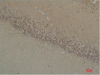 Fig2:; Immunohistochemical analysis of paraffin-embedded Rat Brain Tissue using BAI1 Rabbit pAb diluted at 1:200.