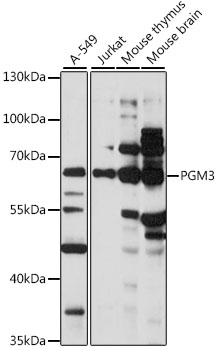 Western blot - PGM3 Polyclonal Antibody 
