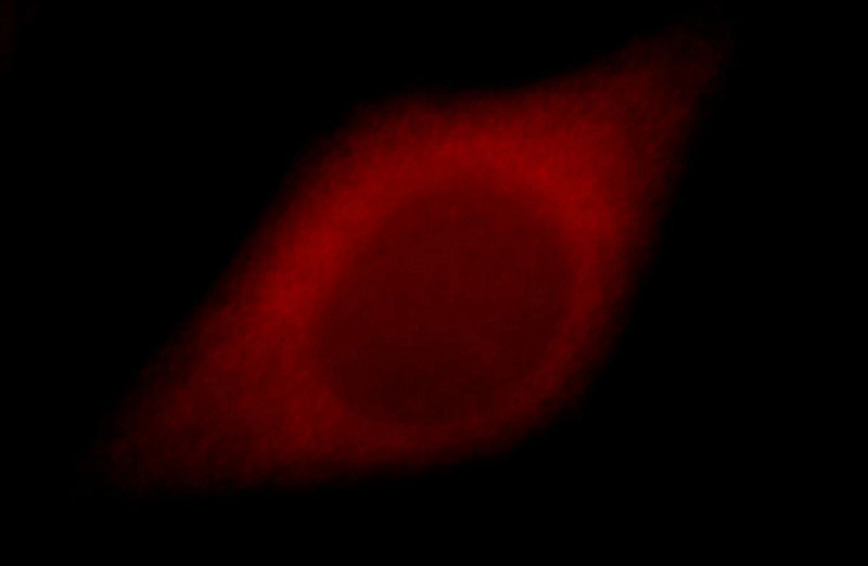 Immunofluorescent analysis of Hela cells, using PAK2 antibody Catalog No:113499 at 1:25 dilution and Rhodamine-labeled goat anti-rabbit IgG (red).