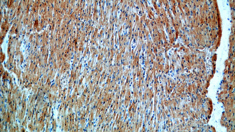 Immunohistochemical of paraffin-embedded human heart using Catalog No:116195(TMEM70 antibody) at dilution of 1:100 (under 10x lens)