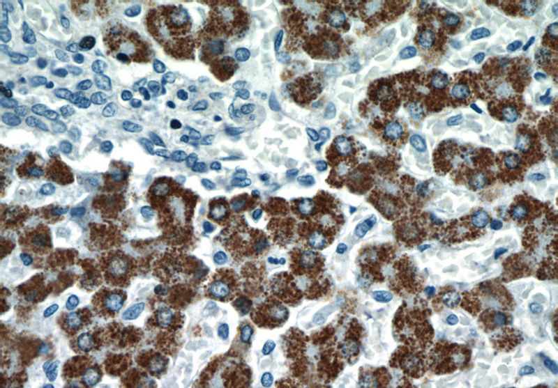 Immunohistochemical of paraffin-embedded human liver using Catalog No:114779(RocK2 antibody) at dilution of 1:100 (under 40x lens)