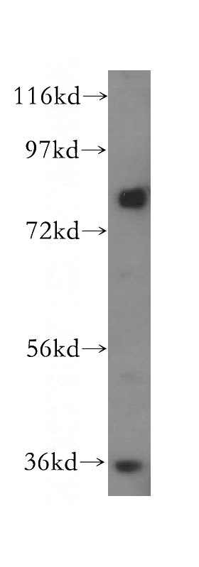 Raji cells were subjected to SDS PAGE followed by western blot with Catalog No:112570(MDM1 antibody) at dilution of 1:500