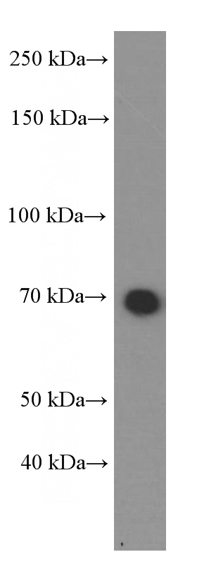 HeLa cells were subjected to SDS PAGE followed by western blot with Catalog No:107267(HSP70 Antibody) at dilution of 1:10000