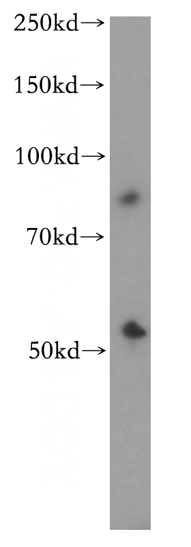 mouse lung tissue were subjected to SDS PAGE followed by western blot with Catalog No:109698(CYP2S1 antibody) at dilution of 1:300