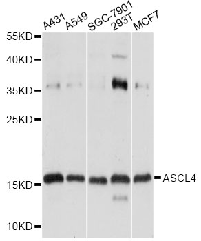 Western blot - ASCL4 Polyclonal Antibody 