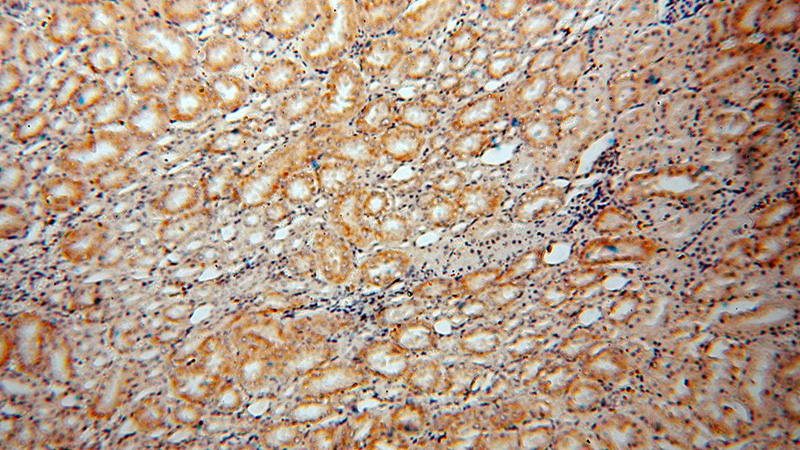 Immunohistochemical of paraffin-embedded human kidney using Catalog No:113726(PEX11G antibody) at dilution of 1:50 (under 10x lens)