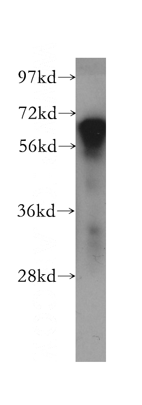 human brain tissue were subjected to SDS PAGE followed by western blot with Catalog No:113656(PDE12 antibody) at dilution of 1:500