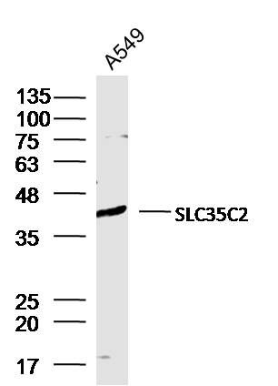 Fig1: Sample:; A549 Cell (Human) Lysate at 30 ug; Primary: Anti-SLC35C2 at 1/300 dilution; Secondary: IRDye800CW Goat Anti-Rabbit IgG at 1/20000 dilution; Predicted band size: 40 kD; Observed band size: 40 kD