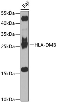 Western blot - HLA-DMB Polyclonal Antibody 