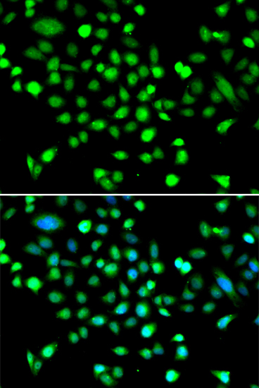 Immunofluorescence - PRKAG1 Polyclonal Antibody 