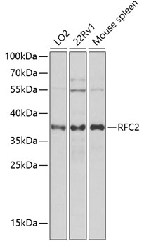 Western blot - RFC2 Polyclonal Antibody 