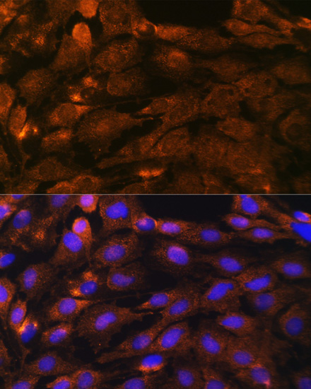 Immunofluorescence - PTCH1 Polyclonal Antibody 