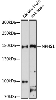 Western blot - NPHS1 Polyclonal Antibody 