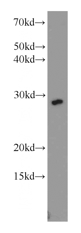 mouse brain tissue were subjected to SDS PAGE followed by western blot with Catalog No:109763(DCUN1D1 antibody) at dilution of 1:300