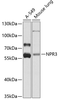 Western blot - NPR3 Polyclonal Antibody 
