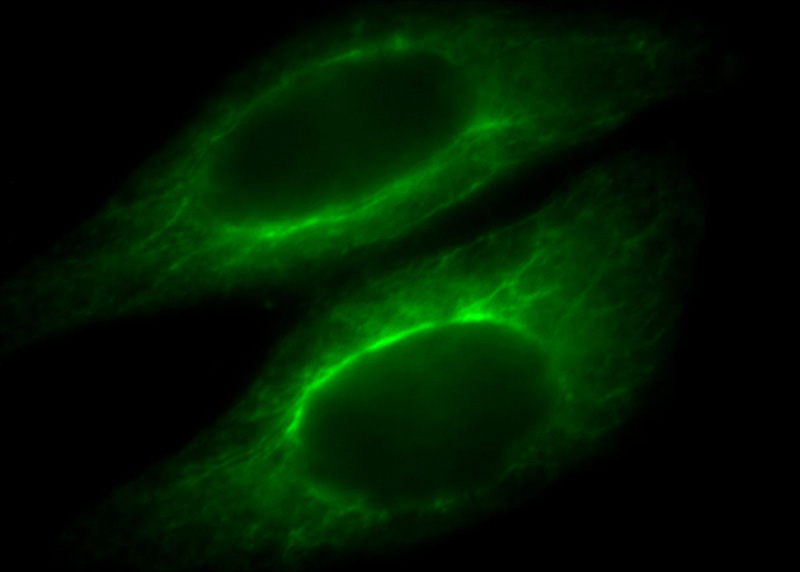 Immunofluorescent analysis of HepG2 cells, using KRT34 antibody Catalog No:112131 at 1:25 dilution and FITC- labeled goat anti-Rabbit IgG (green).