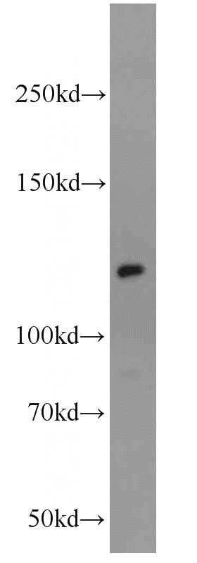 mouse testis tissue were subjected to SDS PAGE followed by western blot with Catalog No:110288(E-cadherin antibody) at dilution of 1:1000