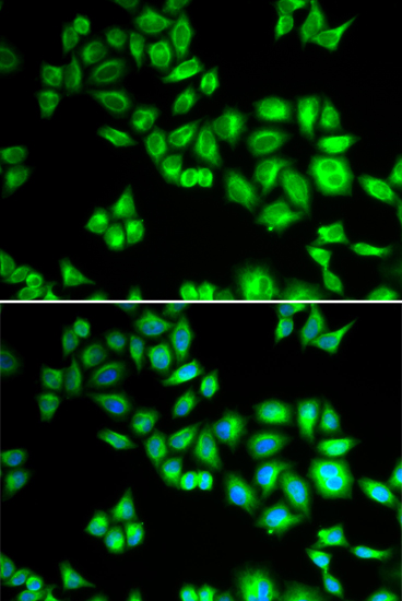 Immunofluorescence - CUL1 Polyclonal Antibody 
