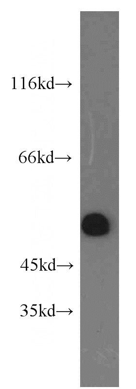 mouse testis tissue were subjected to SDS PAGE followed by western blot with Catalog No:111931(IRGC antibody) at dilution of 1:1000