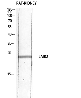 Fig1:; Western blot analysis of RAT-KIDNEY lysis using LAIR2 antibody. Antibody was diluted at 1:1000. Secondary antibody（catalog#：HA1001) was diluted at 1:20000