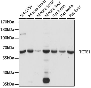 Western blot - TCTE1 Polyclonal Antibody 