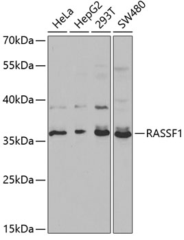 Western blot - RASSF1 Polyclonal Antibody 