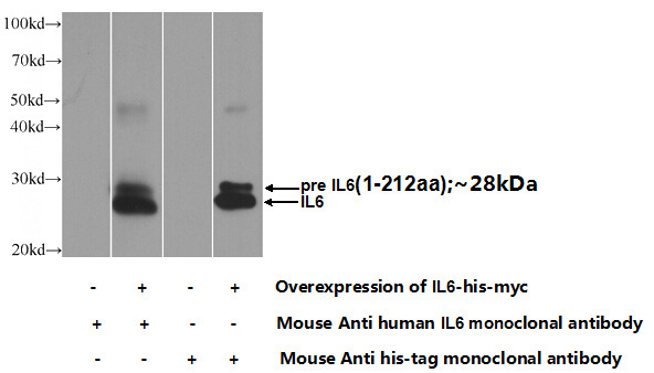 Transfected HEK-293 cells were subjected to SDS PAGE followed by western blot with Catalog No:107402(IL6 Antibody) at dilution of 1:1000