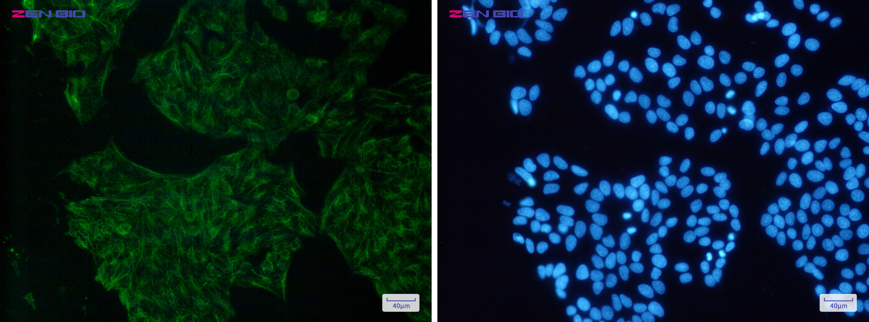 Immunocytochemistry of Cytokeratin 18(green) in Hela cells using Cytokeratin 18 Rabbit pAb at dilution 1/50, and DAPI(blue)
