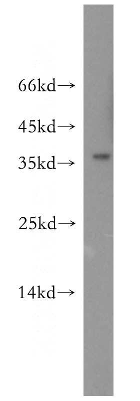 mouse liver tissue were subjected to SDS PAGE followed by western blot with Catalog No:107787(ADH1C antibody) at dilution of 1:4000