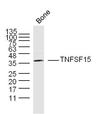 Fig1: Sample:; bone(mouse) Lysate at 40 ug; Primary: Anti-TNFSF15 at 1/300 dilution; Secondary: IRDye800CW Goat Anti-Rabbit IgG at 1/20000 dilution; Predicted band size: 28kD; Observed band size: 38 kD