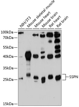 Western blot - SSPN Polyclonal Antibody 