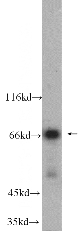 HeLa cells were subjected to SDS PAGE followed by western blot with Catalog No:112718(MNT antibody) at dilution of 1:600