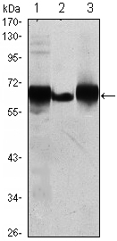 Western blot analysis using ALPP mouse mAb against HepG2 (1), A431 (2) and MCF-7 (3) cell lysate.