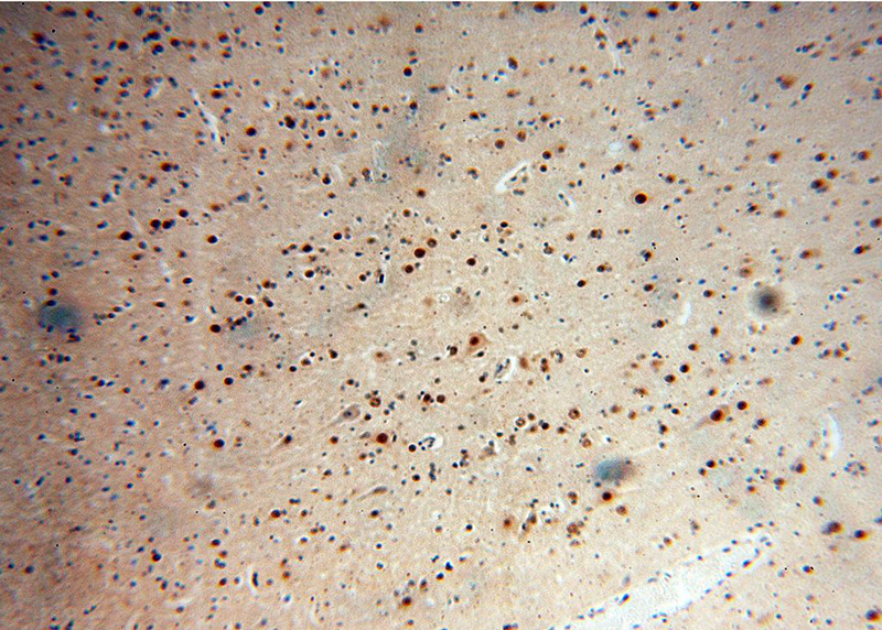 Immunohistochemical of paraffin-embedded human brain using Catalog No:114538(RANBP3L antibody) at dilution of 1:100 (under 10x lens)