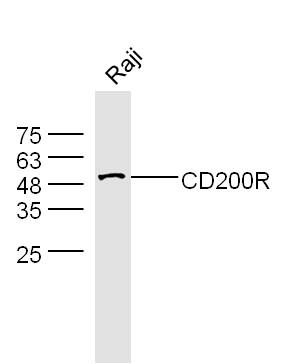 Fig2: Sample: Raji(Human) Cell Lysate at 30 ug Primary: Anti-CD200R at 1/300 dilution Secondary: IRDye800CW Goat Anti-Rabbit IgG at 1/20000 dilution Predicted band size: 33 kD Observed band size: 53 kD