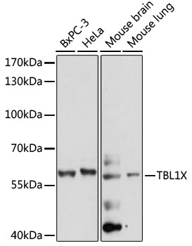 Western blot - TBL1X Polyclonal Antibody 
