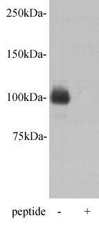 Fig1: Western blot analysis on D3 using anti- PGBD5 polyclonal antibody.