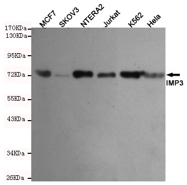 Western blot detection of IMP3 in MCF7,SKVO3,NTERA2,Jurkat,Hela and K562 cell lysates using IMP3 mouse mAb (1:1000 diluted).Predicted band size:70KDa.Observed band size:70KDa.