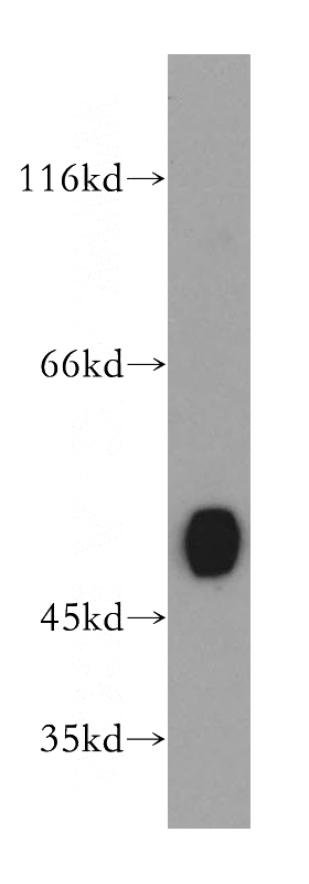 mouse kidney tissue were subjected to SDS PAGE followed by western blot with Catalog No:110887(GATM antibody) at dilution of 1:300