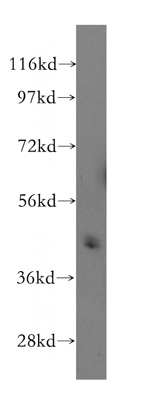 mouse thymus tissue were subjected to SDS PAGE followed by western blot with Catalog No:113650(PELI1 antibody) at dilution of 1:400
